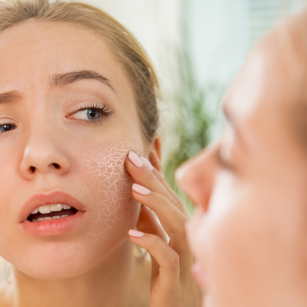 What’s the difference between dry or dehydrated skin?