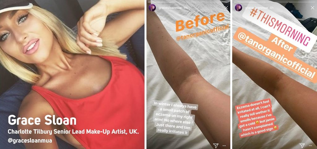 Fake Tanning Solution for people who suffer from Eczema or sensitive skin